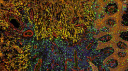 Micro Macro – Life Sciences in Jena