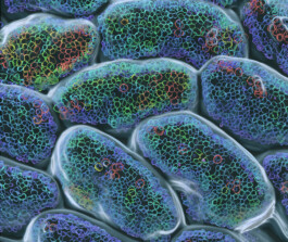 Micro Macro – Life Sciences in Jena