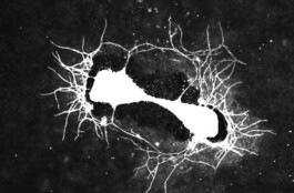 Micro Macro – Life Sciences in Jena